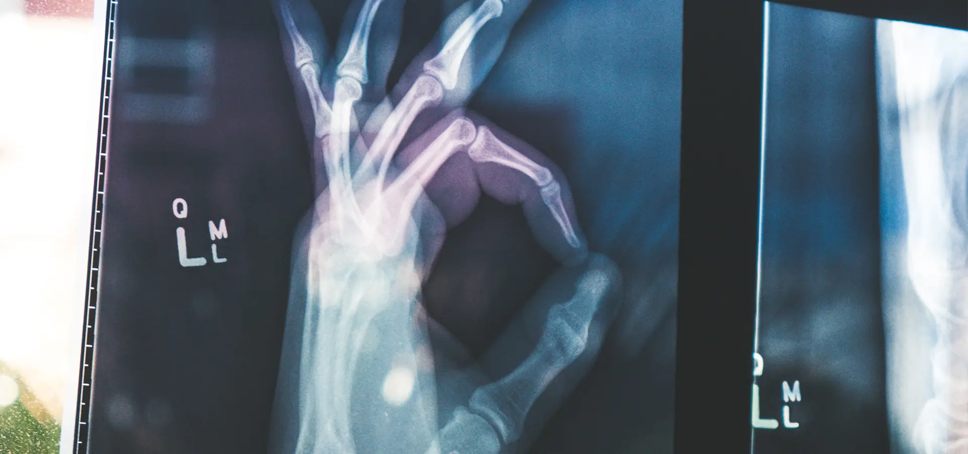 How Exercise Therapy Restores Shoulder Strength & Mobility | Rotator Cuff Recovery